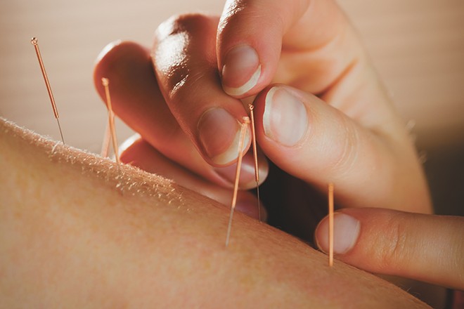 Acupuncture offers a whole body approach to treat a wide variety of troubles – and can cut down on the use of pain medicine. 
https://www.inlander.com/spokane/can-acupuncture-help-prevent-opioid-overuse-and-addiction/Content?oid=18393664_0