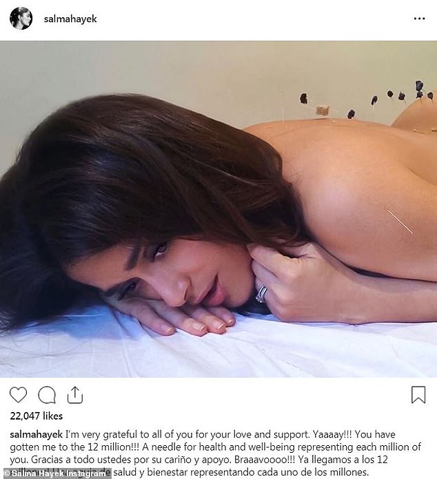 Salma Hayek recently shared this photo of herself getting acupuncture and Instagram went wild!_0