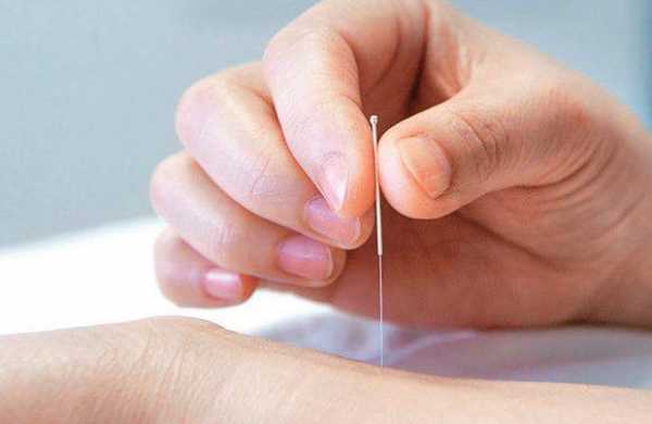 Men struggle with infertility too. Read how the results of a study show the advantages and potential of acupuncture therapy in the treatment of male infertility._0