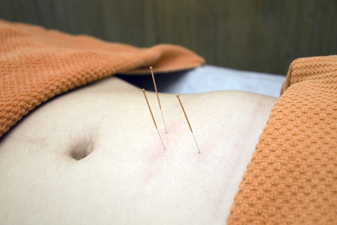 The effects of acupuncture could help treat infertility._0