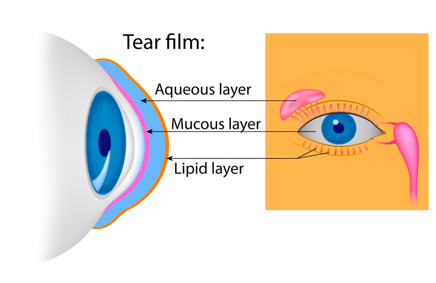 Dry eyes? Try acupuncture before you turn to medicine._0