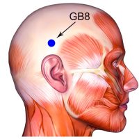 Researchers determined specific acupuncture protocols for many types of headaches...
