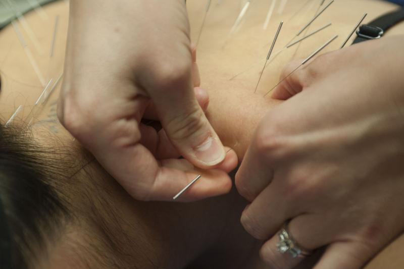 Acupuncture may reduce pain in cancer patients._0